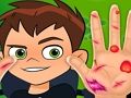 Spill Ben10 håndlege  online