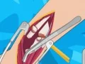 Spill Arm surgery 2 online