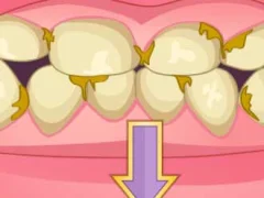 Spill Bad Teeth Makeover online