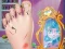 Spill Ladybug Foot Surgery online
