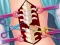 Spill Anna Scoliosis Surgery online